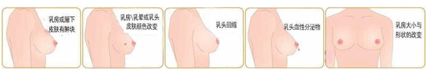 乳腺增生頁面-840_05.gif